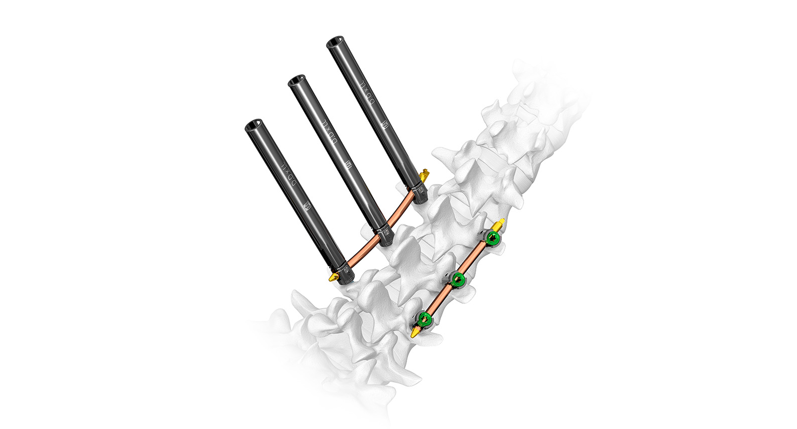 MIS Ultra® - Spinal Elements