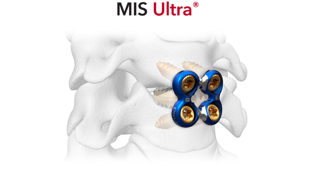 Sapphire X MIS Ultra Cervical Fixation Plate System Spinal Elements