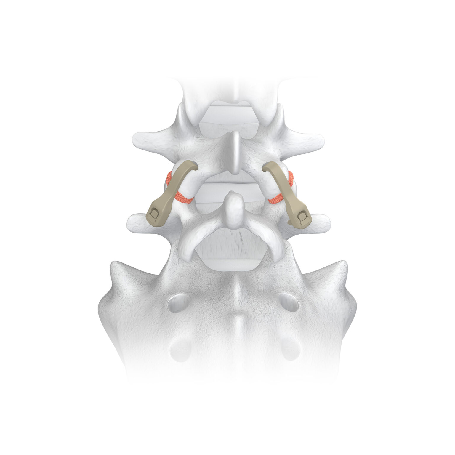 Newsroom - Spinal Elements