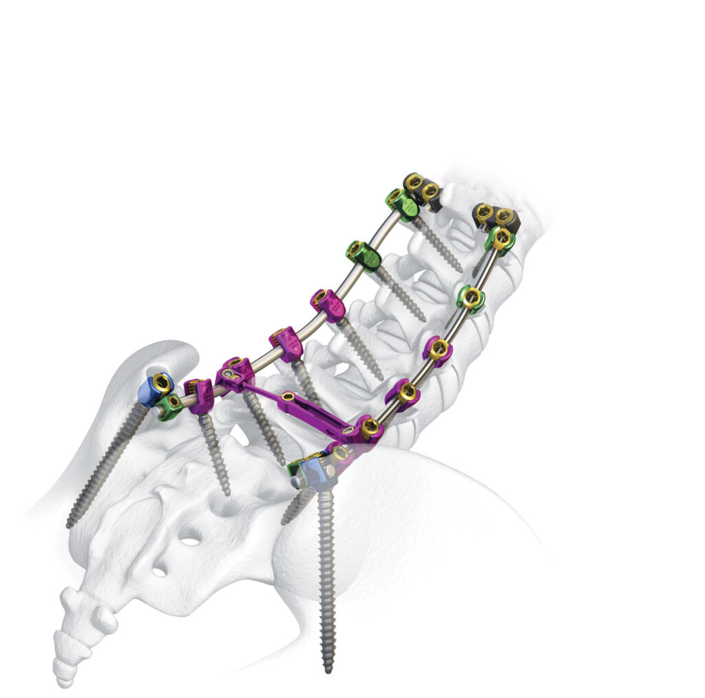 Mercury Total Spine Thoracolumbar Fixation System_Spinal Elements