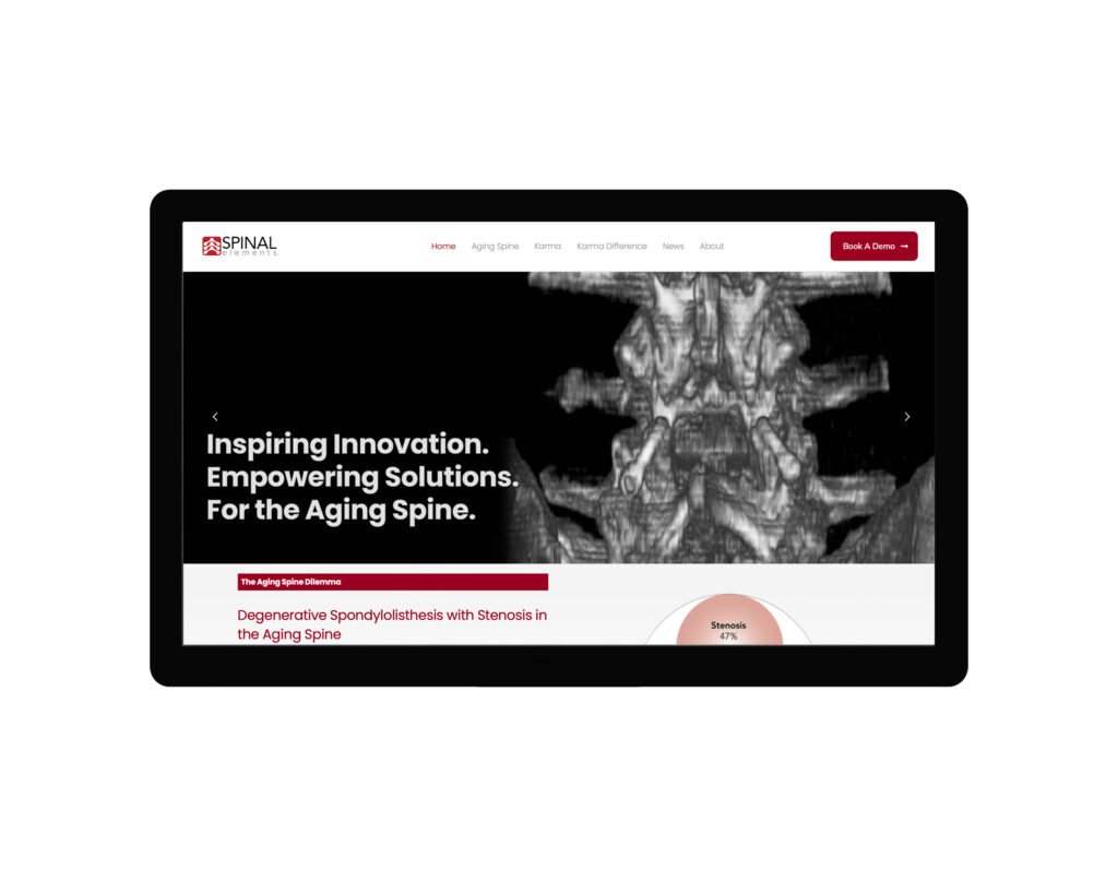 Newsroom - Spinal Elements