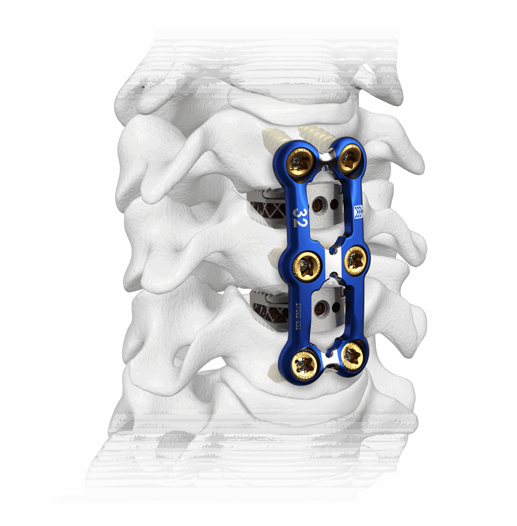 Sapphire X Multilevel Cervical Plate
